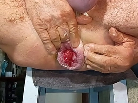 Gapingman 2025-14 asian gay big cock sex videos