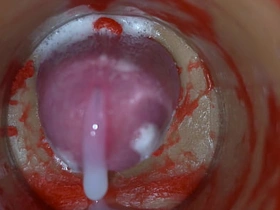 Insemination - Internal Camera Captures Deep Male Ejaculation detached asian sex videos boyfriendtv.com